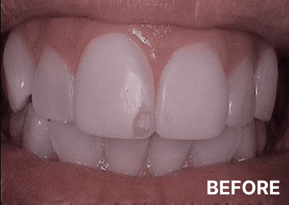 before-10